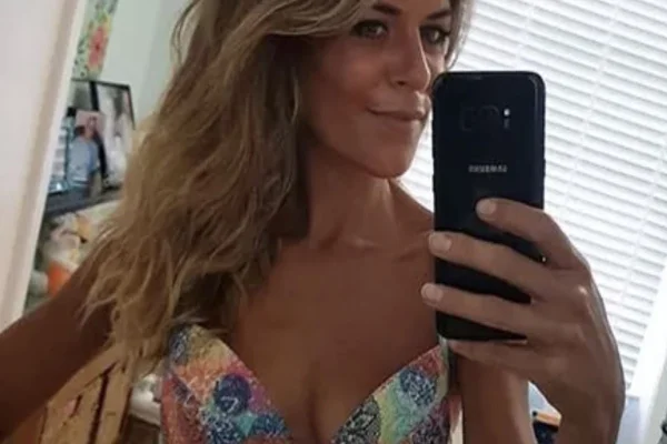 Foto colorida da atriz inglesa que por conta de anorexia e bulimia teve que extrair os dentes