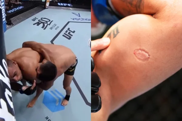 Brasileiro é demitido após morder adversário no UFC - Metrópoles