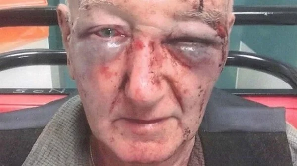 Idoso tenta impedir homem de urinar na rua e acaba espancado