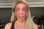Maya Massafera revelou que vai fazer um novo procedimento em alguns meses