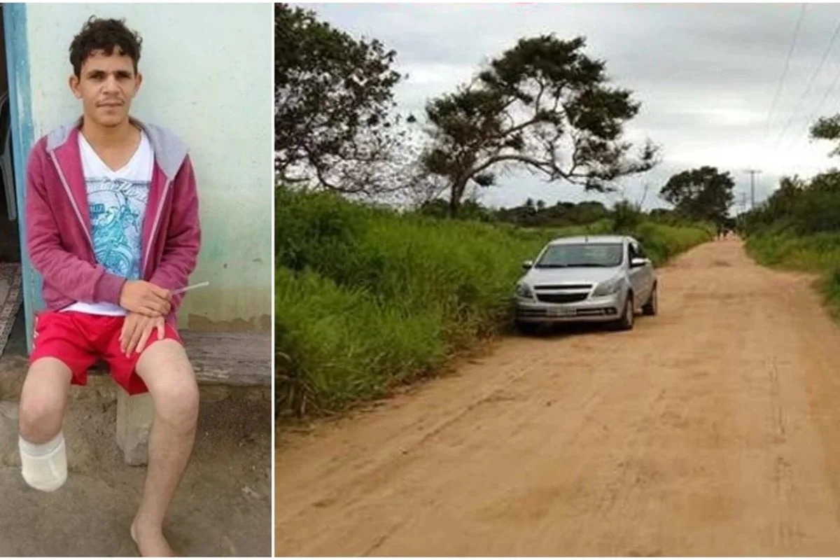 Servidor amputa a própria perna para aplicar golpe de R$ 1,5 milhão no seguro