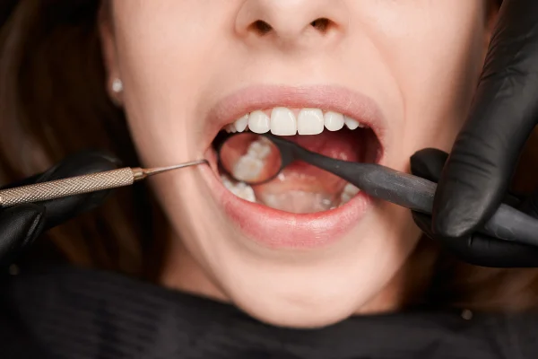 Imagem mostra uma mulher fazendo uma avaliação dentária - Metrópoles