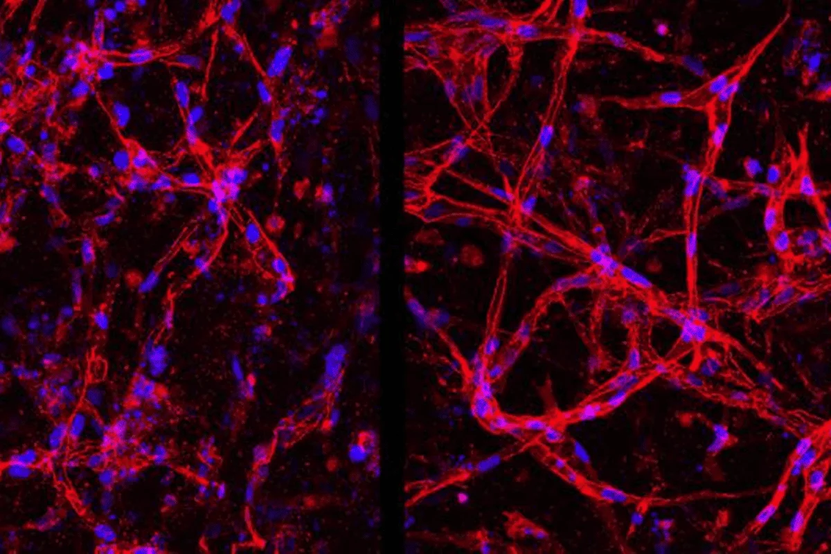 Cientistas da Duke criam células da retina em laboratório e avançam na cura da cegueira
