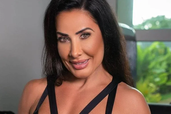 Scheila Carvalho desarmonização