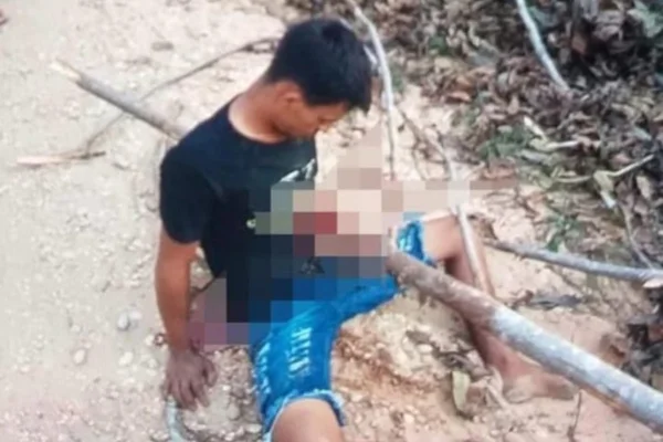 Imagem colorida mostra jovem que teve corpo atravessado por árvore em cidade do Tocantins - metrópoles