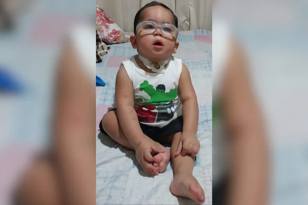 Imagem colorida de bebê com traqueostomia - Metrópoles