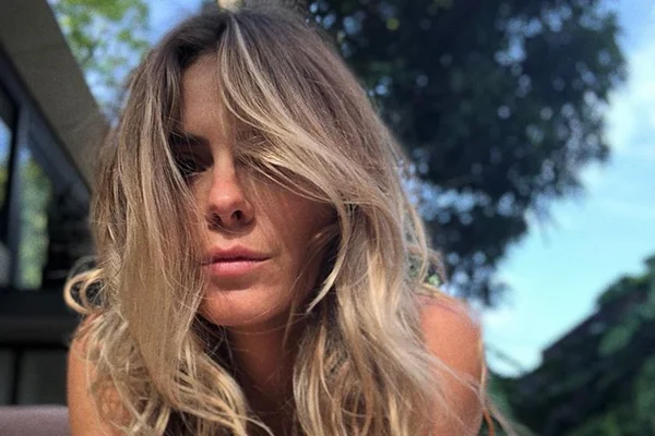 Carolina Dieckmann aparece com rosto irreconhecível e fãs se assustam