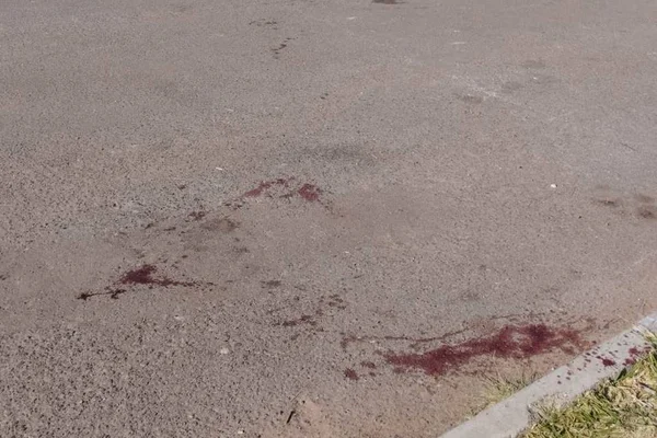 Homem é morto e tem a cabeça arrancada com foice no Pará