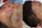 Ferimentos na cabeça do menino Ferimentos na cabeça do menino