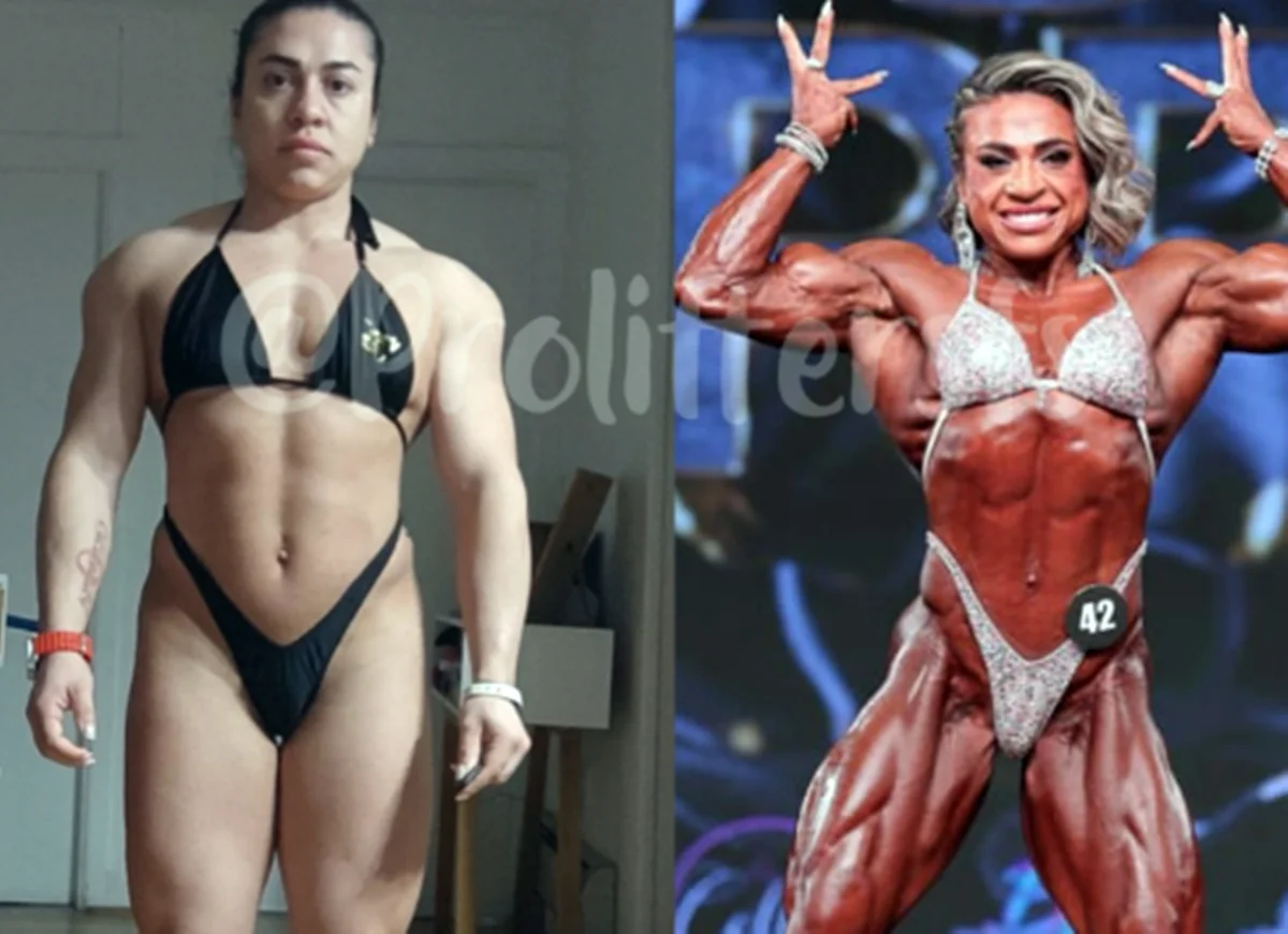 Antes e depois de Marianne Von Gierke Antes e depois de Marianne Von Gierke