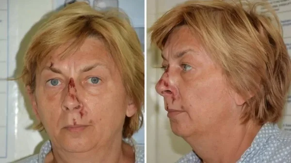 Mulher encontrada estava ferida e não se lembra quem é ou de onde veio