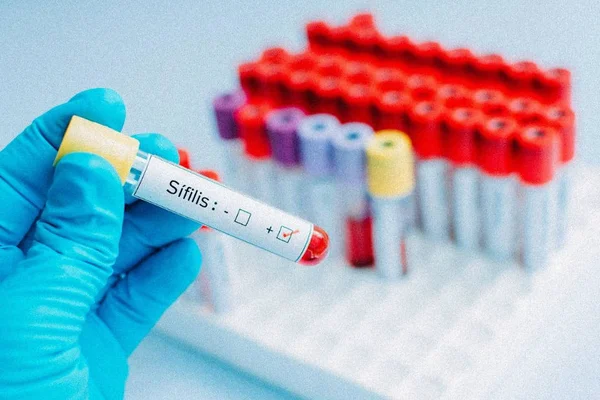 Distrito Federal registra queda no número de casos de sífilis congênita