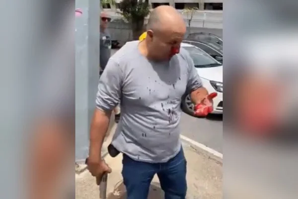 pm paisana agredido nariz quebrado minas