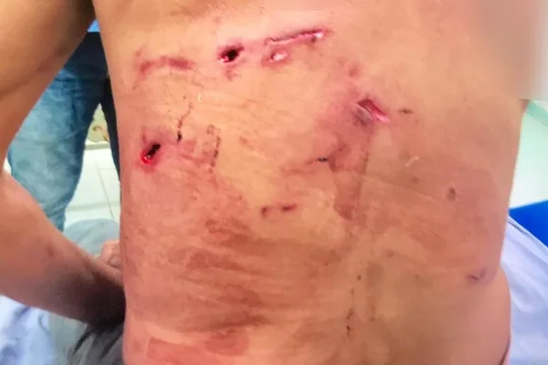 Homem atacado por onça-pintada é salvo pelos 5 cachorros de estimação