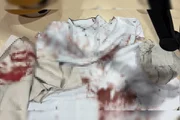 Roupas sujas de sangue