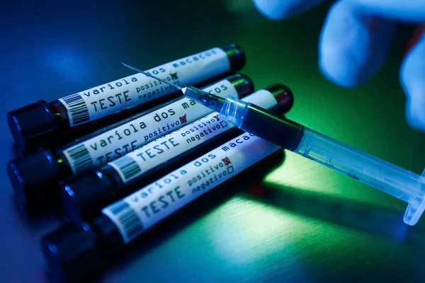 banco de imagem seringa ampola teste variola macaco monkeypox saude doença mpox