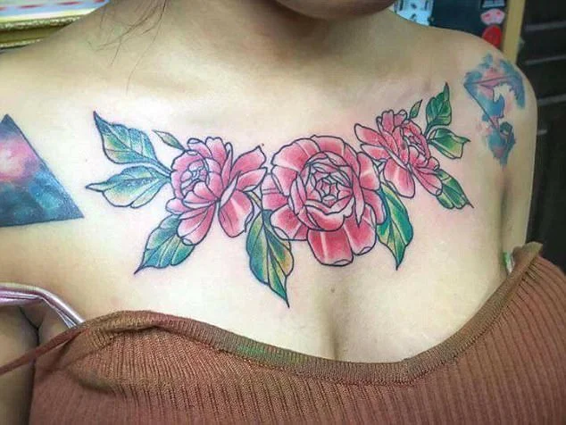 Garota relata momentos de dor ao remover tatuagem com método polêmico - imagem 2 Garota relata momentos de dor ao remover tatuagem com método polêmico - imagem 2