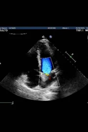 Vittor Fernando publicou registros do hospital e do carro atingido após atentado Vittor Fernando publicou registros do hospital e do carro atingido após atentado