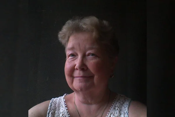 Teresa Jones doença de pele rara gangrena 3