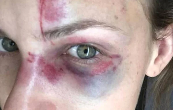 Jovem agredida nos EUA grava parte de briga com namorado brasileiro