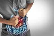 Alguns alimentos irritam o intestino, como frituras, produtos ultraprocessados e bebidas alcoólicas Alguns alimentos irritam o intestino, como frituras, produtos ultraprocessados e bebidas alcoólicas