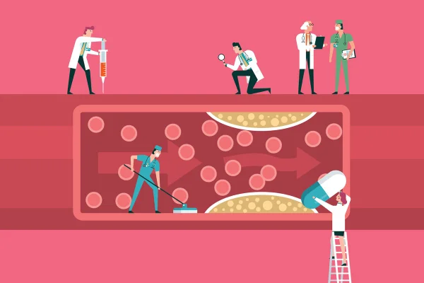 ilustração de médicos investigando artéria