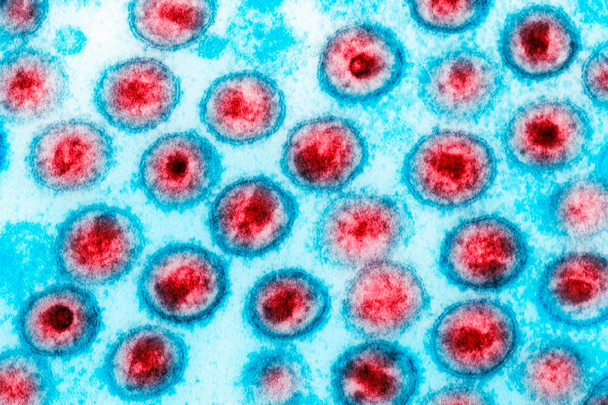 Medicamento de câncer reduz células infectadas por HIV em estudo