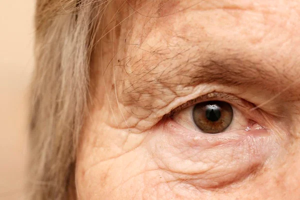 Médicos encontram 27 lentes de contato alojadas nos olhos de idosa