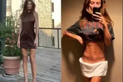 Cintia Dicker mostra "antes e depois" de massagem