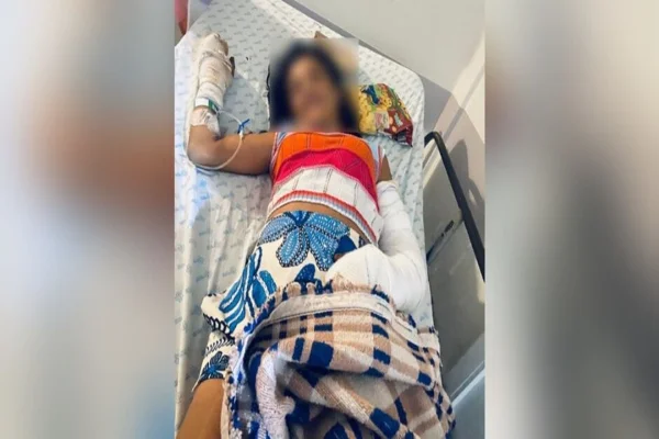 Imagem colorida, MS: mulher agredida com 2 braços quebrados espera cirurgia há 4 dias- Metrópoles