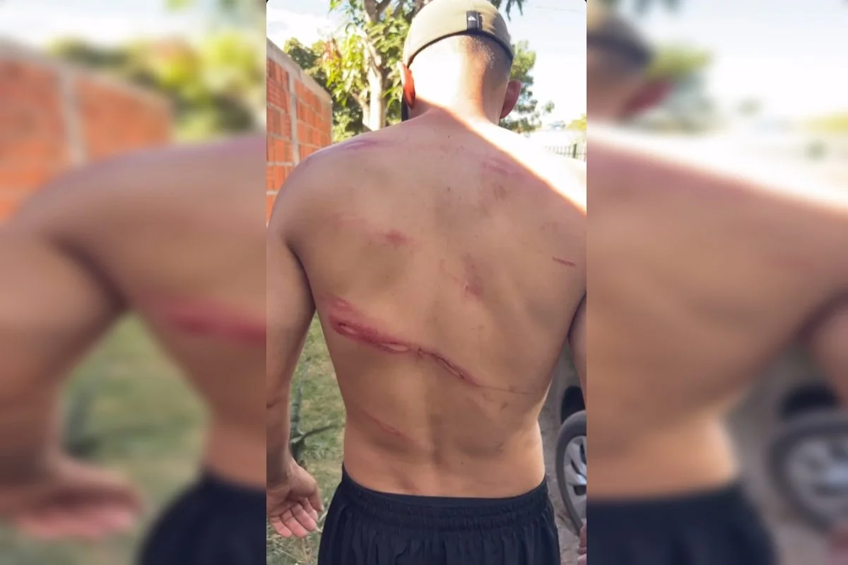 PMDF: Família acusa policiais de truculência em festa de aniversário