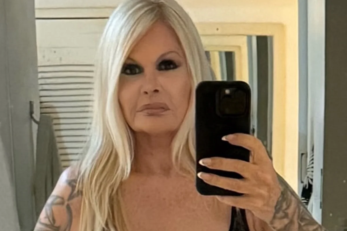 Monique Evans relara problema com o banco após cirurgia no rosto Monique Evans relara problema com o banco após cirurgia no rosto