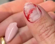 Aline Gotschalg surge com o dedo sangrando e desabafa: "Dia de sorte"
