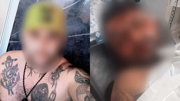 Tatuador fica cego e irmã pede prisão de ex-mulher: “Louca enciumada”