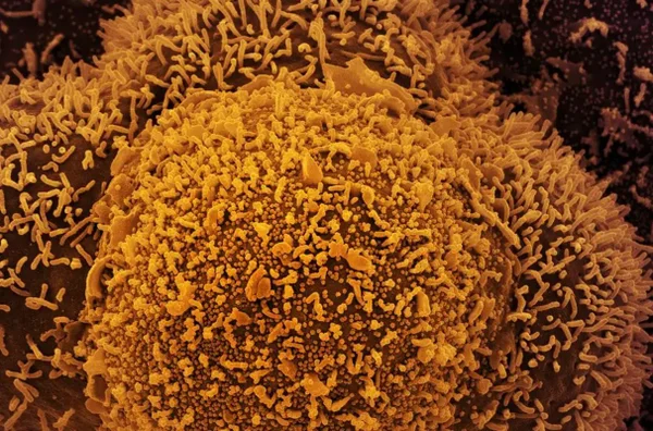Imagem colorida de Nova variante da Covid