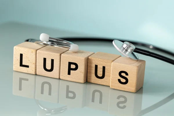Lúpus, Lúpus Eritematoso Sistêmico. Doença autoimune. Distúrbios do sistema imunológico. Estetoscópio médico e palavra escrita em blocos de madeira, fundo azul pastel, espaço para texto.