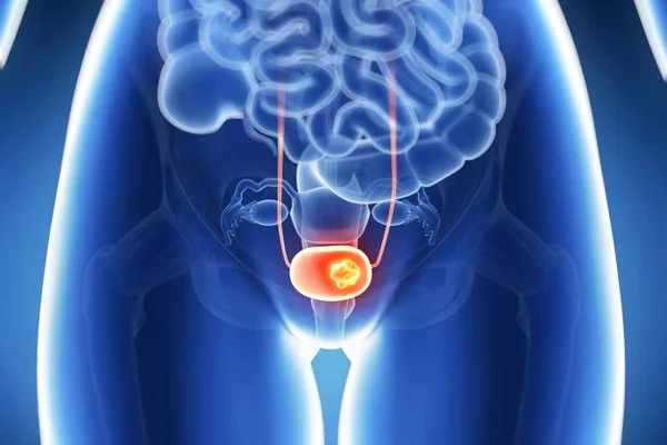 Ilustração colorida de sistema urinário com bexiga em laranja
