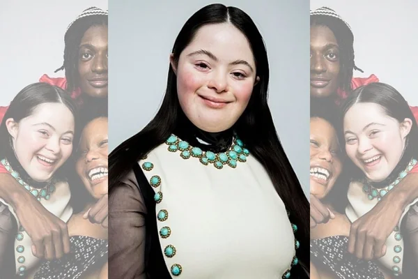 Primeira modelo com síndrome de Down da Gucci