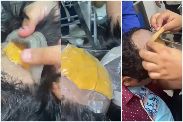 Homem flagrado com ouro debaixo da careca