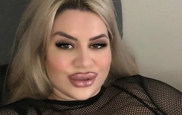 Modelo faz cirurgia para ter bumbum de 2 metros e impressiona