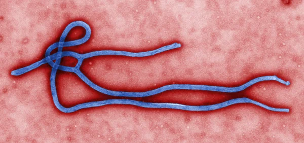 vírus ebola