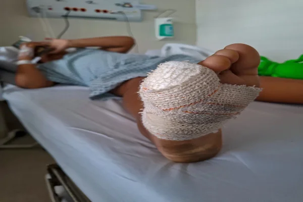 Imagem colorida, Henzo Gabriel, de 8 anos, teve parte do dedo mindinho do pé direito amputada - Metrópoles