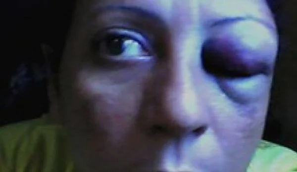 “Não me arrependo”, diz jornalista do Acre que agrediu mulher com soco