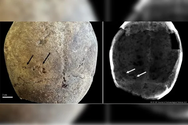 Análise de tecido cerebral de duas múmias encontradas em cemitério de Milão