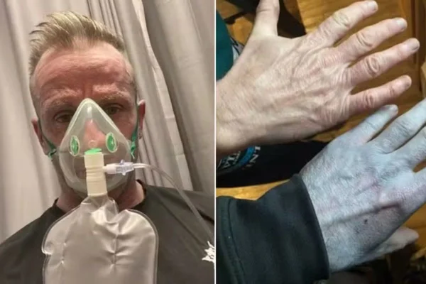 Homem vê partes do corpo azuladas, vai ao hospital e se surpreende