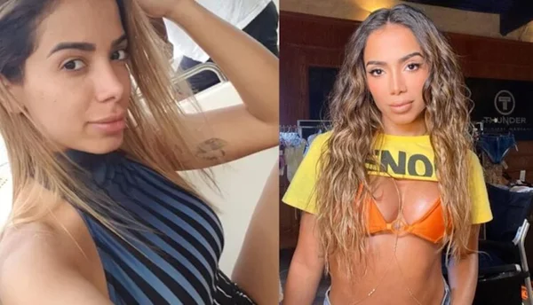 Beleza natural: veja a pele de 25 famosas sem maquiagem