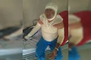 PCDF procura suspeito de atear fogo em homem que dormia na rua - imagem 2 PCDF procura suspeito de atear fogo em homem que dormia na rua - imagem 2