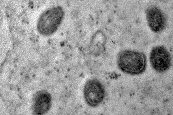 imagem do vírus monkeypox feita pela fiocruz