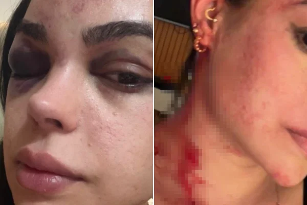 Ex-primeira-dama acusa prefeito de agredi-la na frente do filho de 7 anos
