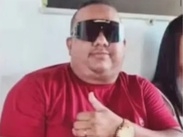 Foto colorida de Alex Pereira Santos picado por abelha - Metrópoles